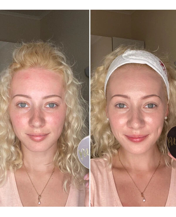 Dr.Hedison Многофункциональный кушон с пептидами | Miracle Cushion SPF50 PA+++ фото, цена, купить
