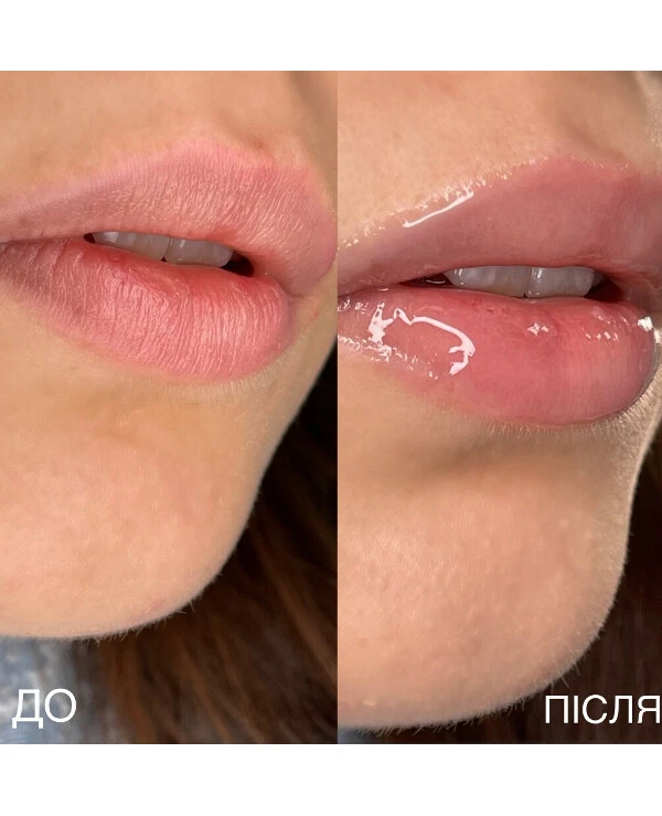 Pittoresco Moisturizing lip balm | Moisturizing oil for lips_4