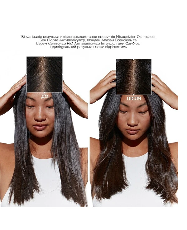 Kerastase Интенсивная ночная сыворотка для чувствительной кожи головы, склонной к появлению перхоти | Symbiose Intensive Anti-Dandruff Cellular Night Serum фото, цена, купить