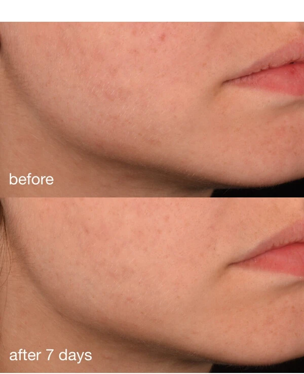 Dermalogica Антиоксидантная сыворотка с коллагеном | Pro-Collagen Banking Serum фото, цена, купить