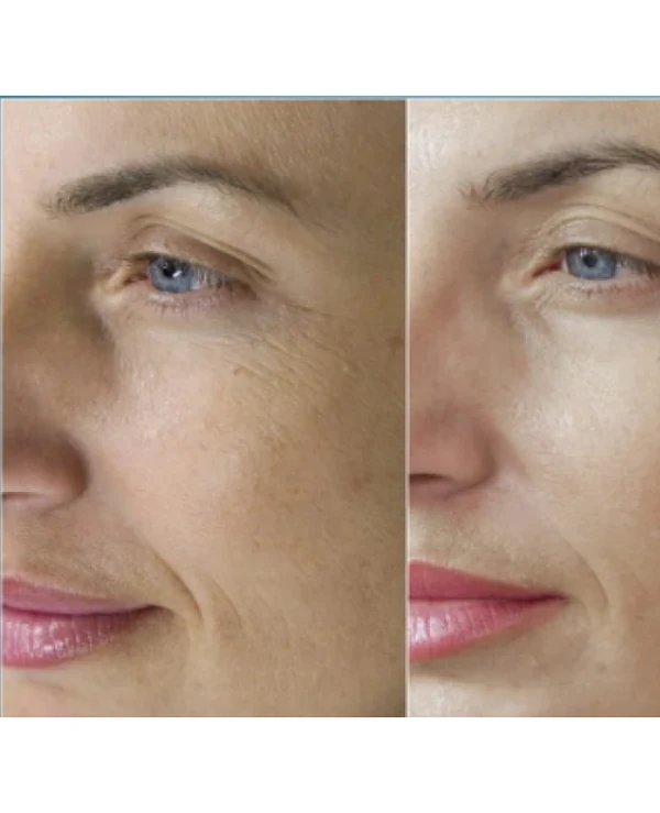 Bravity Очищающая пенка-желе для лица с лактобактериями | Очищающая пенка-желе для лица с лактобактериями Daily Barrier Cleansing Jelly Foam