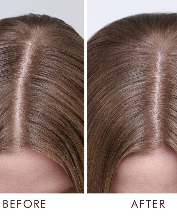MoroccanOil Средство по уходу за сухой кожей головы | Moroccanoil Dry-No-More Средство по уходу за сухой кожей головы