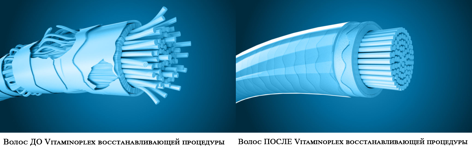 Vitaminoplex Two-phase hair regeneration 2-Step Hair Reconstruction System Discount, special offer, buy. - Online Store AZUM